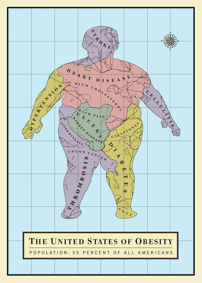 Alice Drueding y Joe Scorsone - United States of obesity, 2014